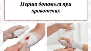 Перша допомога при кровотечах