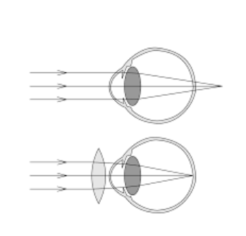 040011bt-f8db-349x335.png