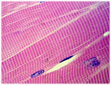 0400658h-c708-388x298.png