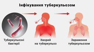 Дисципліна м-тво у внутрішній м-ні Діяльність медсестри при вирішенні проблем пацієнта з туберкульозом легень№6