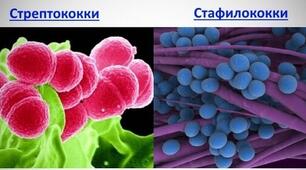Патогенні коки