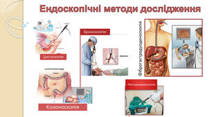 Підготовка пацієнта до ендоскопічних методів дослідження 