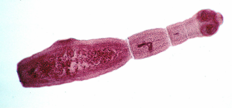 Parazitológiai (Trichinella, Echinococcus) projekt - Nébih