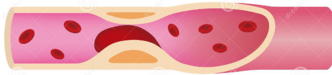 0400heb6-9509-332x75.png