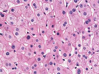 0400iasb-5abd-331x248.jpg