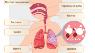 Діагностувальна робота " Як уберегтися від застуди"