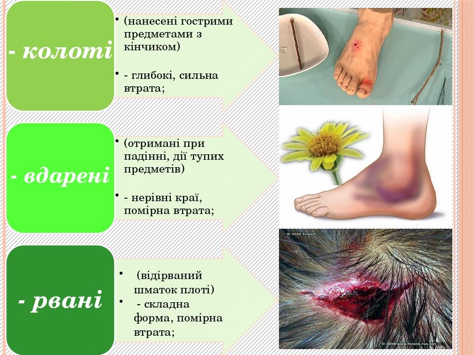 Види ран. Ускладнення ран | Презентація. Захист України