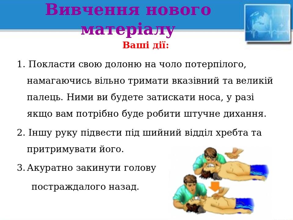 Вивчення нового матеріалу Ваші дії: 1. Покласти свою долоню на чоло потерпілого, намагаючись вільно тримати вказівний та великій палець. Ними ви бу...