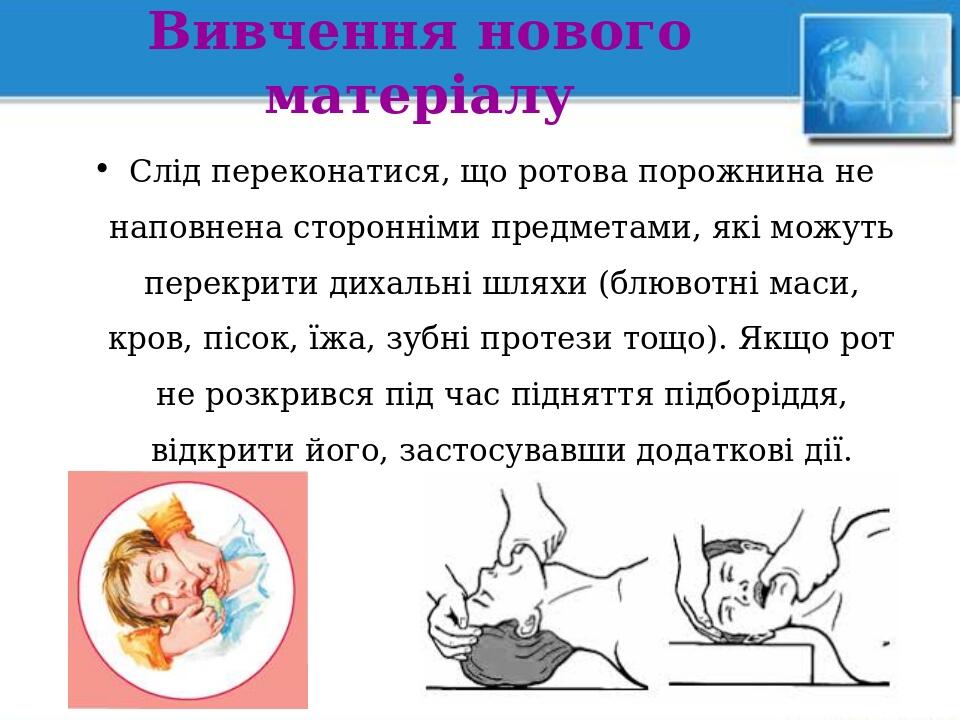 Вивчення нового матеріалу Слід переконатися, що ротова порожнина не наповнена сторонніми предметами, які можуть перекрити дихальні шляхи (блювотні ...