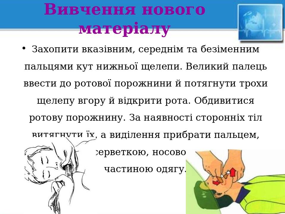 Вивчення нового матеріалу Захопити вказівним, середнім та безіменним пальцями кут нижньої щелепи. Великий палець ввести до ротової порожнини й потя...