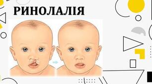 Презентація з теми: "Ринолалія"