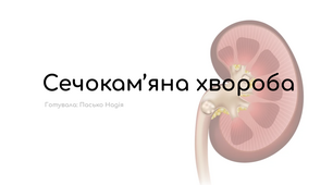 Презентація на тему "Сечокам'яна хвороба".