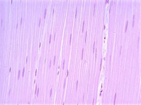 04019icx-c9c9-287x215.jpg