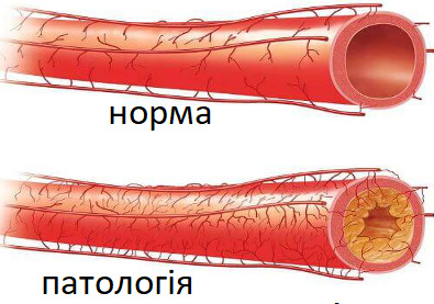 0401b680-5262-395x277.jpg