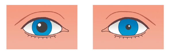 0401btky-ba63-605x191.png