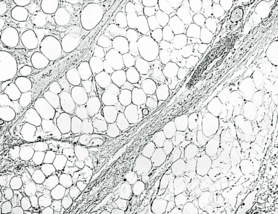 0401ftax-c1e8-278x214.png