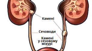  8 клас Захворювання сечовидільної системи та їх профілактика