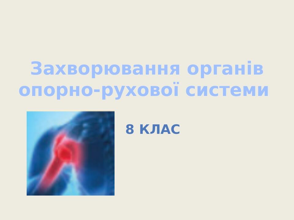 Захворювання органів опорно-рухової системи 8 клас