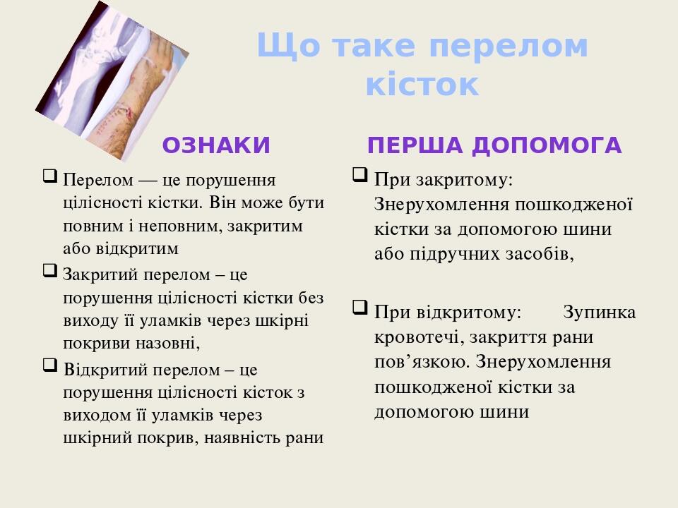 Що таке перелом кісток Ознаки Перелом — це порушення цілісності кістки. Він може бути повним і неповним, закритим або відкритим Закритий перелом – ...