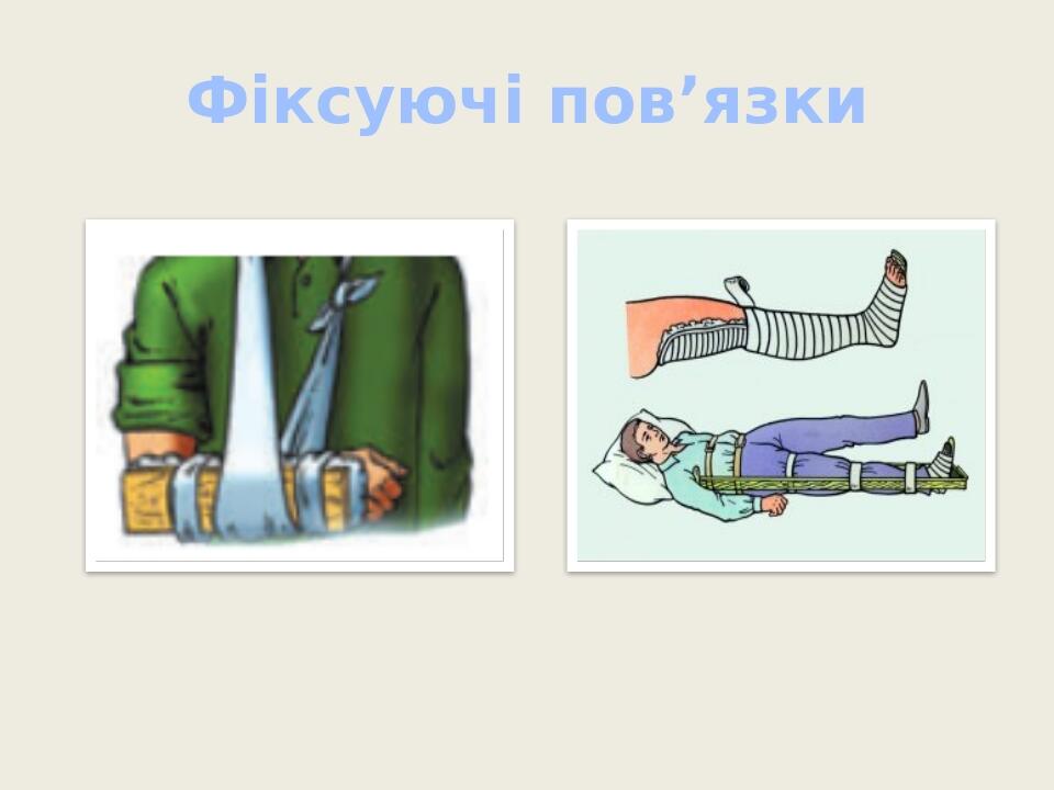 Фіксуючі пов’язки