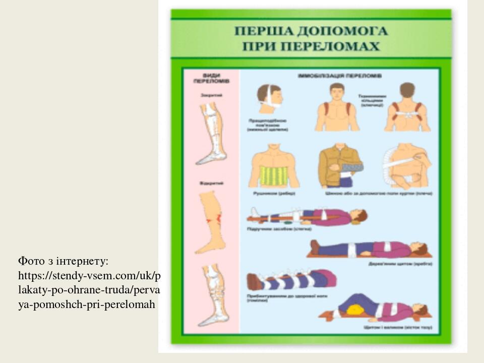 Фото з інтернету: https://stendy-vsem.com/uk/plakaty-po-ohrane-truda/pervaya-pomoshch-pri-perelomah
