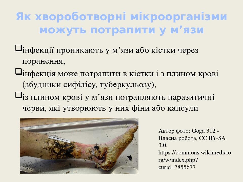 Як хвороботворні мікроорганізми можуть потрапити у м’язи інфекції проникають у м’язи або кістки через поранення, інфекція може потрапити в кістки і...