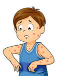 1,632 Rash Cartoon Stock Photos and Images - 123RF