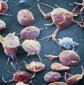 Blood platelets - Stock Image - P256/0045 - Science Photo Library
