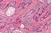 04022mpl-3700-173x111.png