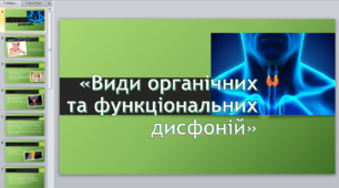 Презентація на тему «Види органічних та функціональних дисфоній»