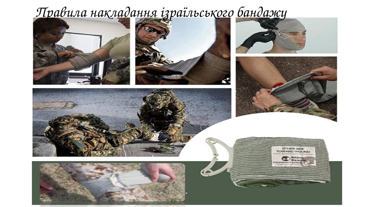 Правила накладання ізраїльського бандажу