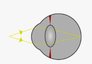 04028v2y-9649-325x225.png
