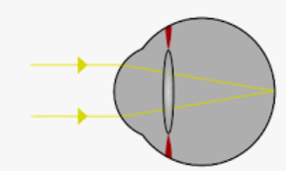 04028v34-acc6-313x187.png