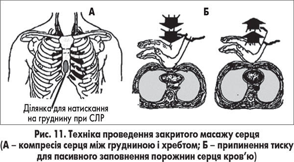ris11