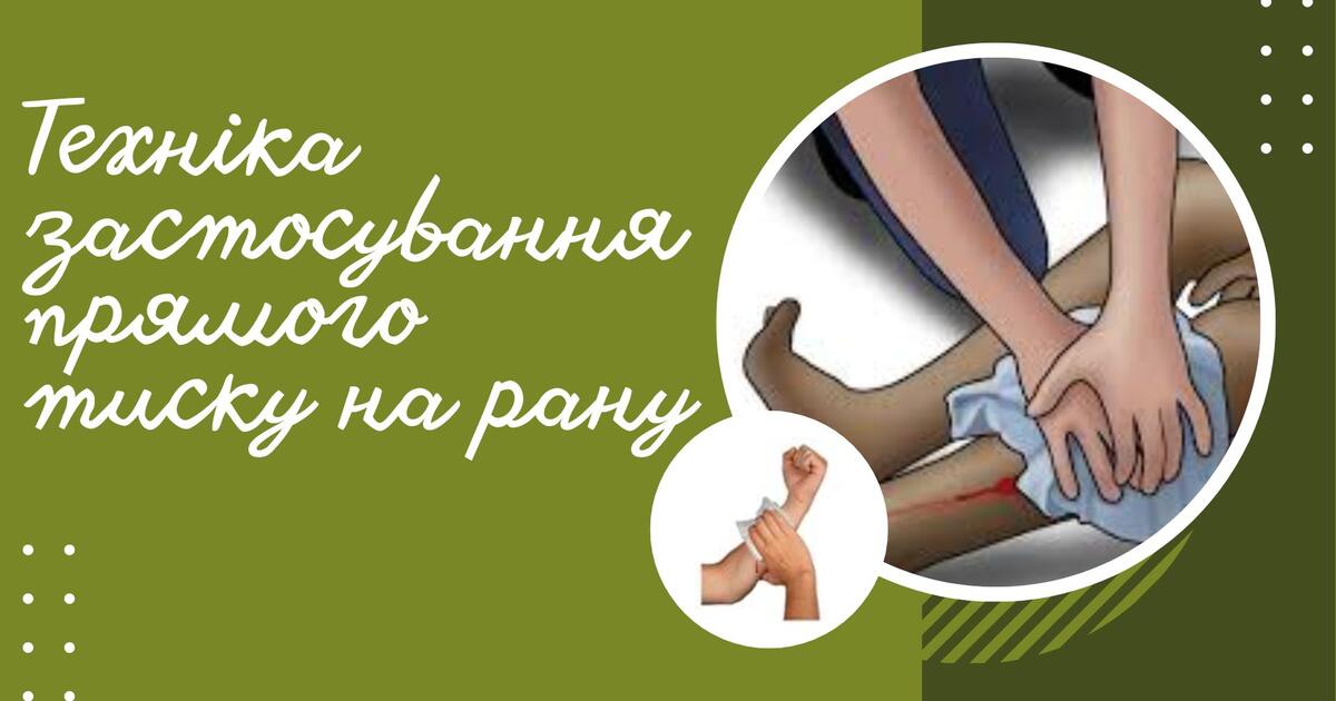Презентація. Техніка застосування прямого тиску на рану. Захист України ...