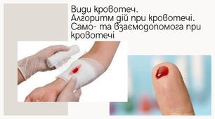 Захист України 10 клас. Види кровотеч.  Алгоритм дій при кровотечі.  Само- та взаємодопомога при кровотечі
