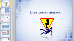 Презентація на тему "Електричні травми"
