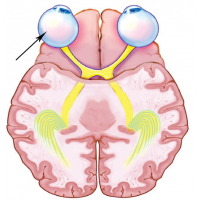 0402mt36-bc4a-200x200.png