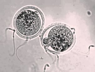0402nztr-307e-304x230.png