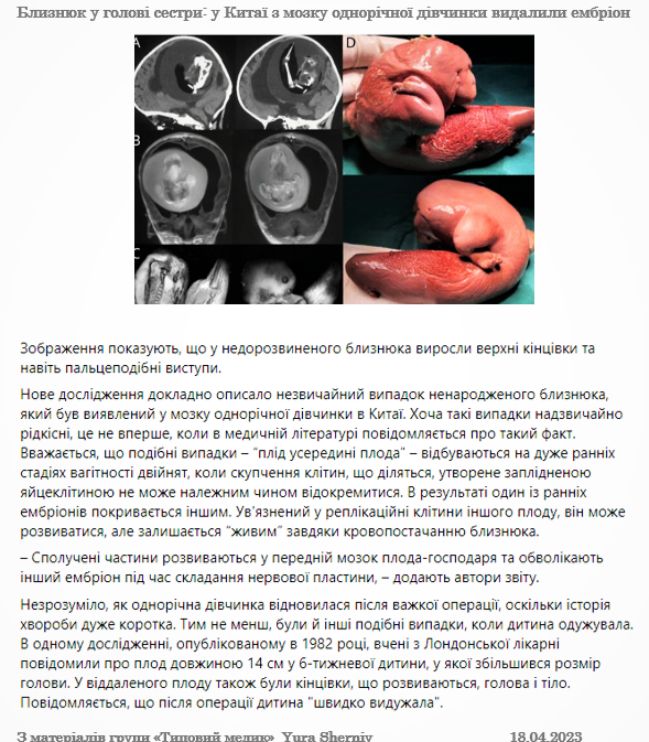 0402q4jn-c7d2-589x673.png