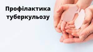 Профілактика туберкульозу.