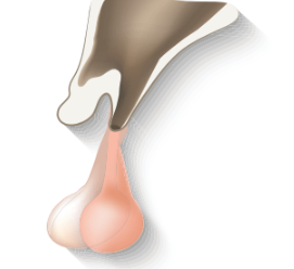 0402yqja-1a79-271x248.png