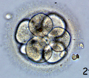 0402zpyl-3663-286x252.png